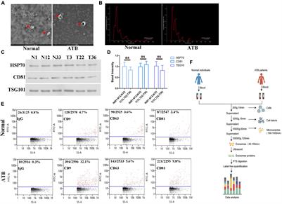 Proteomics Analysis of Exosomes From Patients With Active Tuberculosis Reveals Infection Profiles and Potential Biomarkers